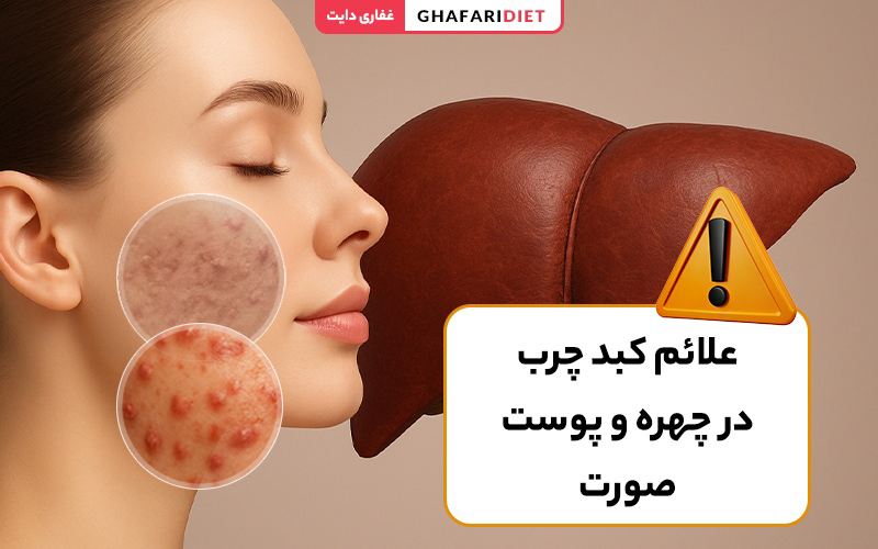 بیماری های کبدی و پوست صورت